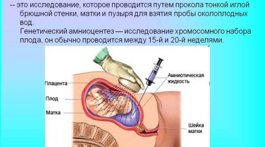 Анализ околоплодных вод: определение патологий при беременности