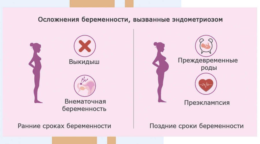 Беременность при эндометриозе: возможно ли счастье для женщины?