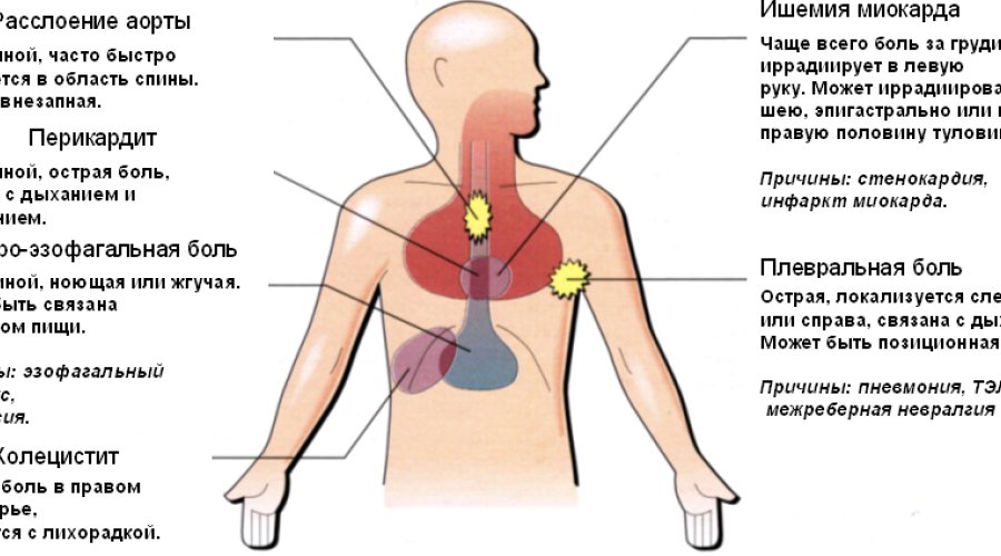 Боль в груди: причины и лечение боли в области грудной клетки