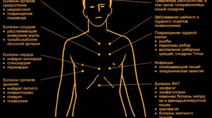 Боль в левой груди у женщин: причины, симптомы и возможные заболевания