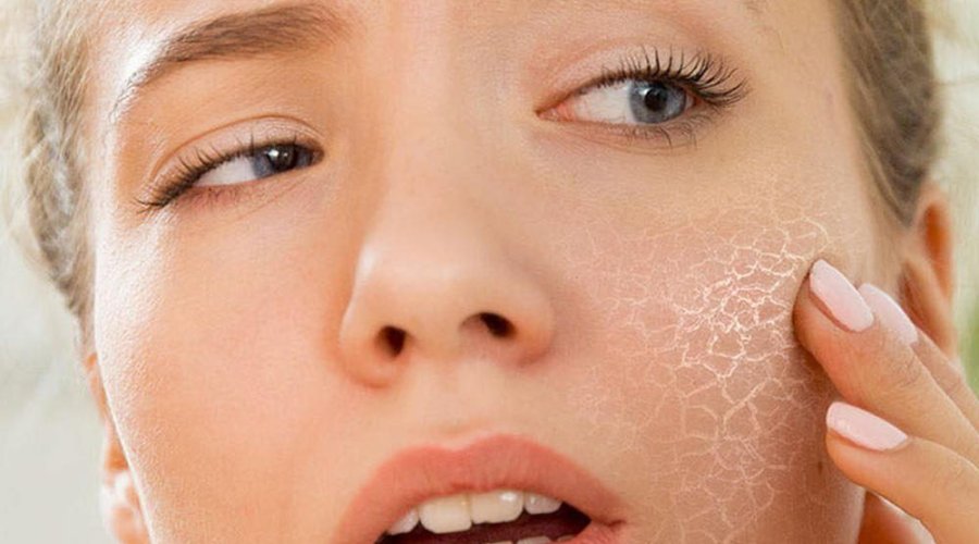 Чем опасно обезвоживание кожи лица и как бороться с ним