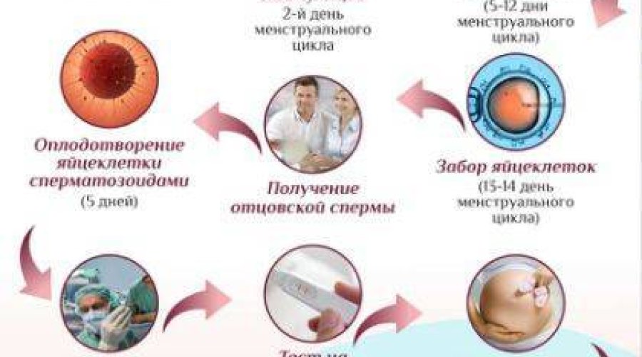 Чем отличается беременность после ЭКО от естественной