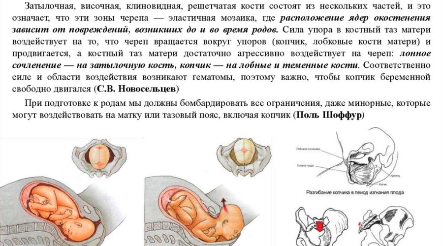 Что делать при боли копчика во время беременности