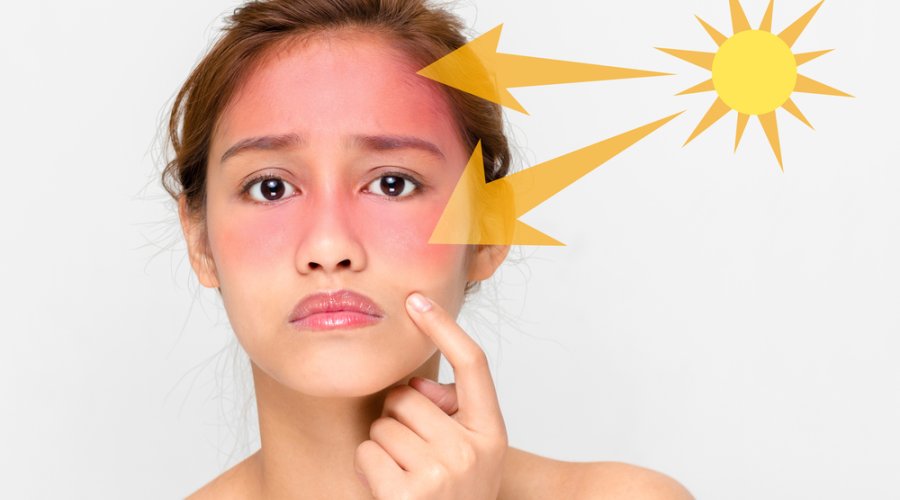 Что такое фотостарение и как защитить кожу от негативного воздействия солнечных лучей