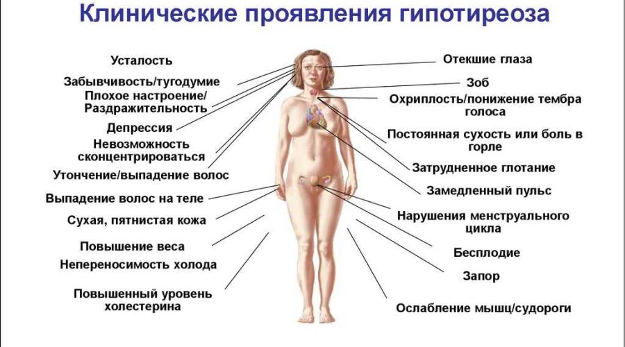 Гипотиреоз при беременности – причины, симптомы и лечение