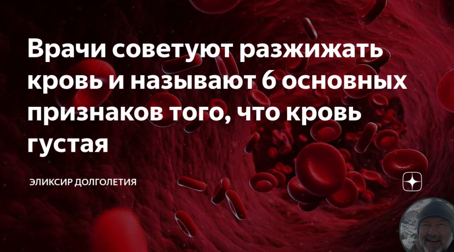 Густая кровь у женщин: причины, лечение и диета