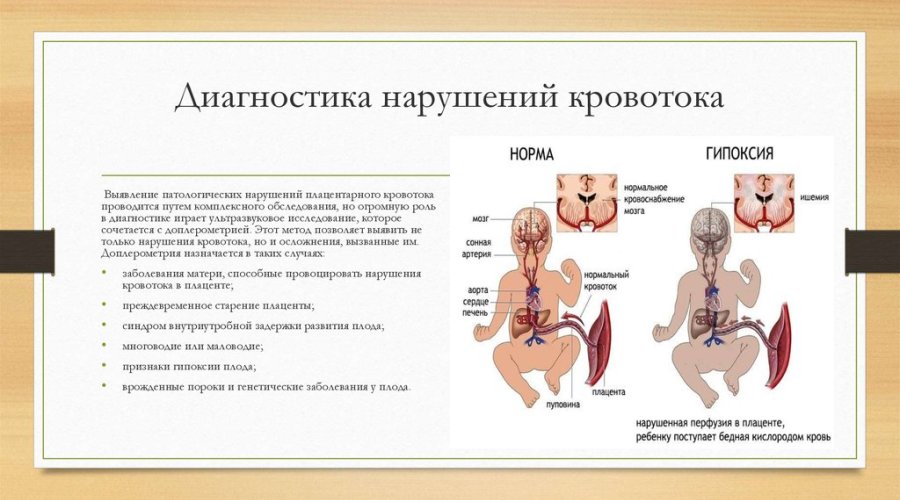 Как избежать нарушения кровотока во время беременности