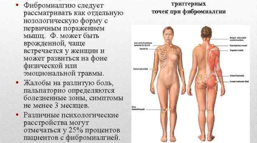 Как различить фибромиалгию от конкурирующих заболеваний