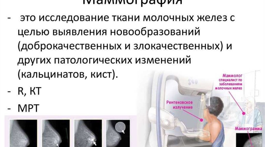 Маммография молочных желез — правила и особенности проведения процедуры
