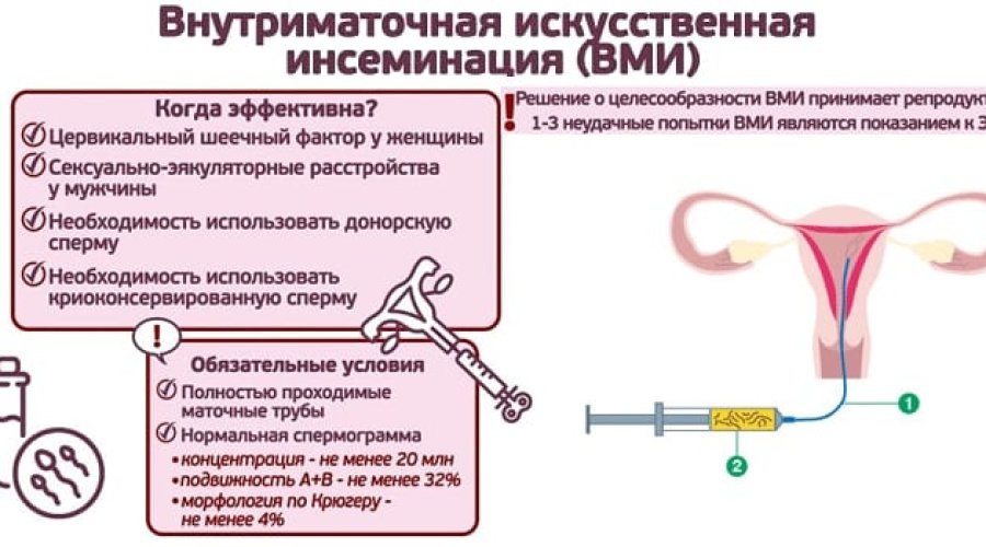 Методика внутриматочной инсеминации: основные этапы и рекомендации