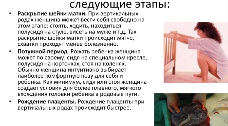 Мягкие роды: особенности и преимущества