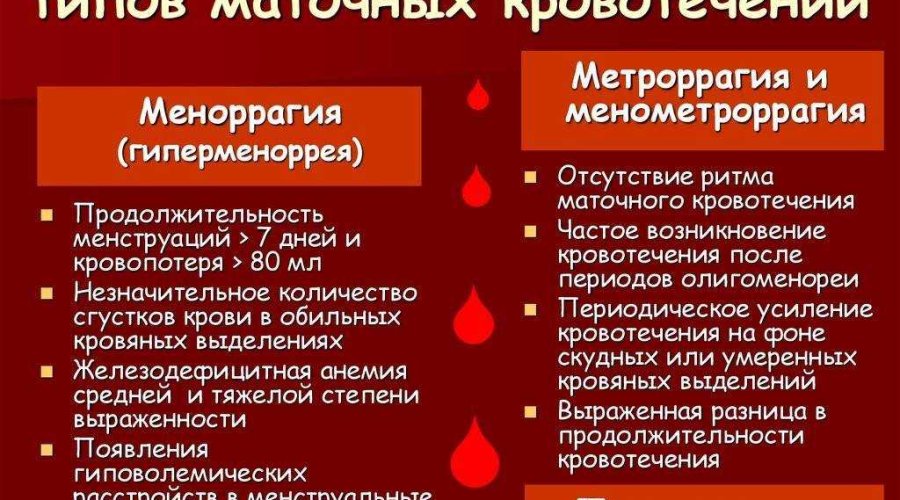 Обильные месячные или маточное кровотечение — как различить симптомы?