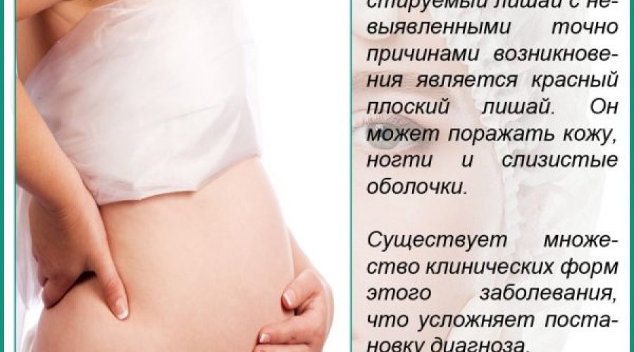 Опасности розового лишая во время беременности и эффективное лечение