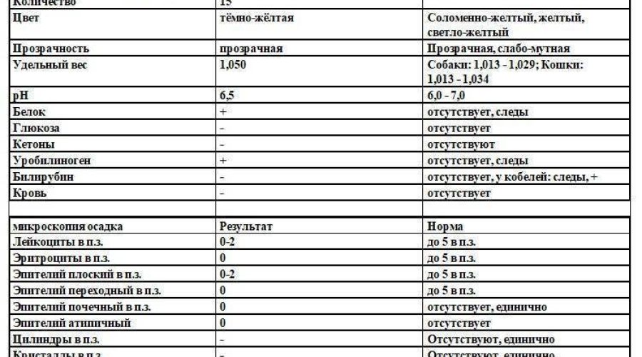 Плоский эпителий в моче у ребенка: причины и расшифровка