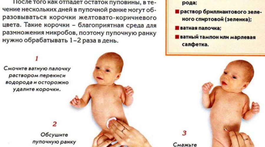 Правильный уход за пупком у новорожденных: советы и рекомендации