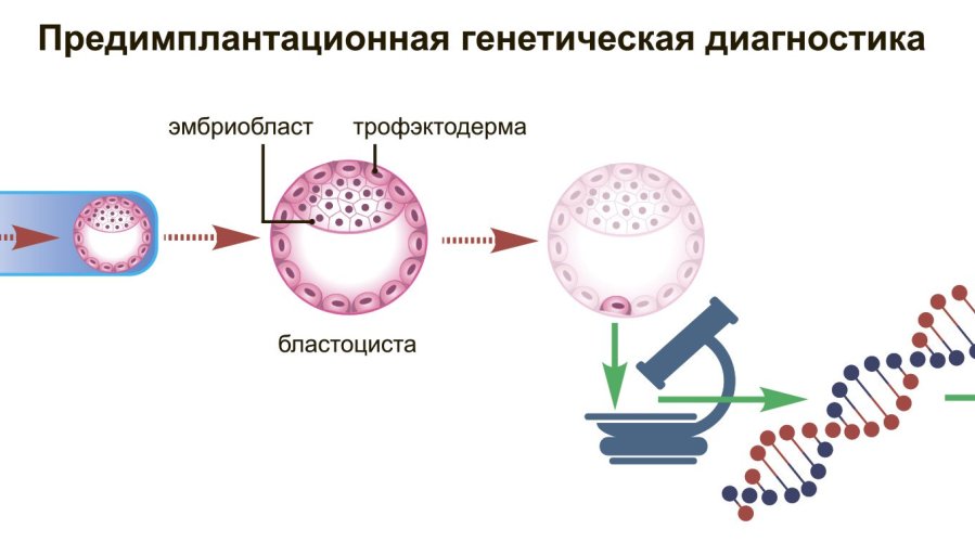 Предимплантационная генетическая диагностика эмбрионов: новости и актуальная информация