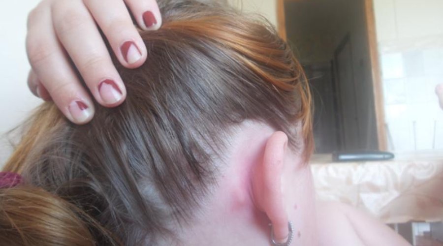 Причины и эффективное лечение шишки за ухом у ребенка