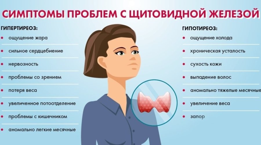 Симптомы и лечение заболеваний щитовидной железы у женщин