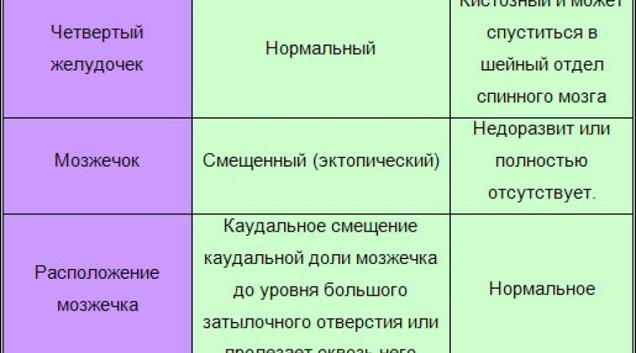 Синдром Денди-Уокера: все о клинических проявлениях и лечении