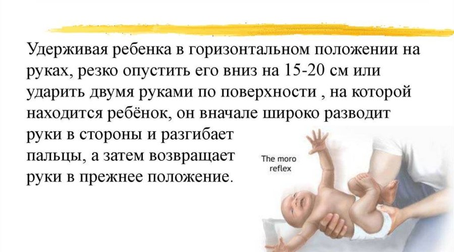 Сохранение рефлекса Моро у новорожденных: основные причины и сроки