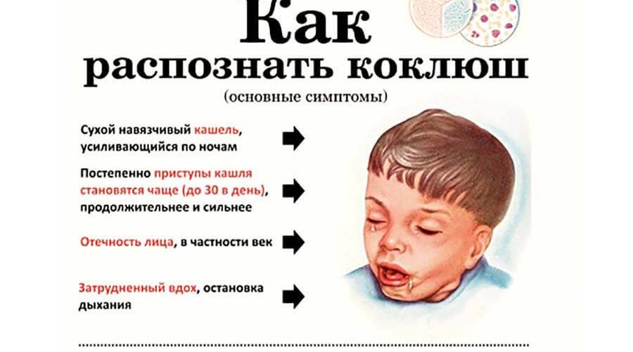 Сухой кашель у детей — причины, симптомы, лечение.