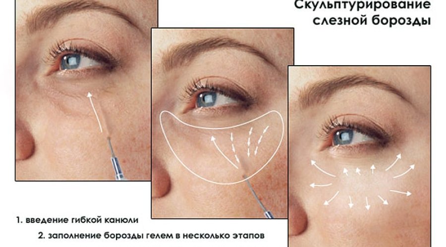 Уплотнение и омоложение кожи под глазами: эффективные методы и средства