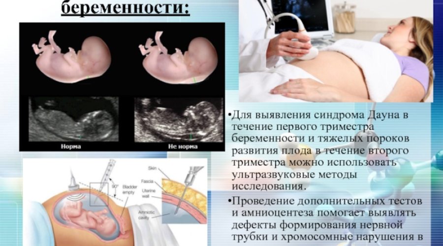 Важная информация о скрининговых УЗИ при беременности: полезные советы и рекомендации