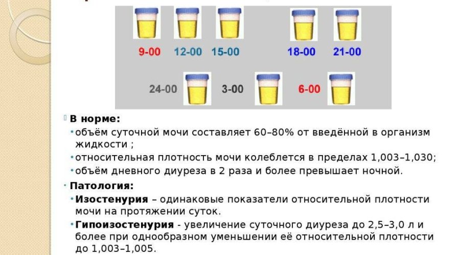 Зачем проводят анализ мочи по Зимницкому — полезная информация и описание метода