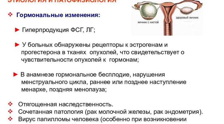 Заголовок: «Симптомы и лечение цистаденомы яичников: основные признаки и методы борьбы»